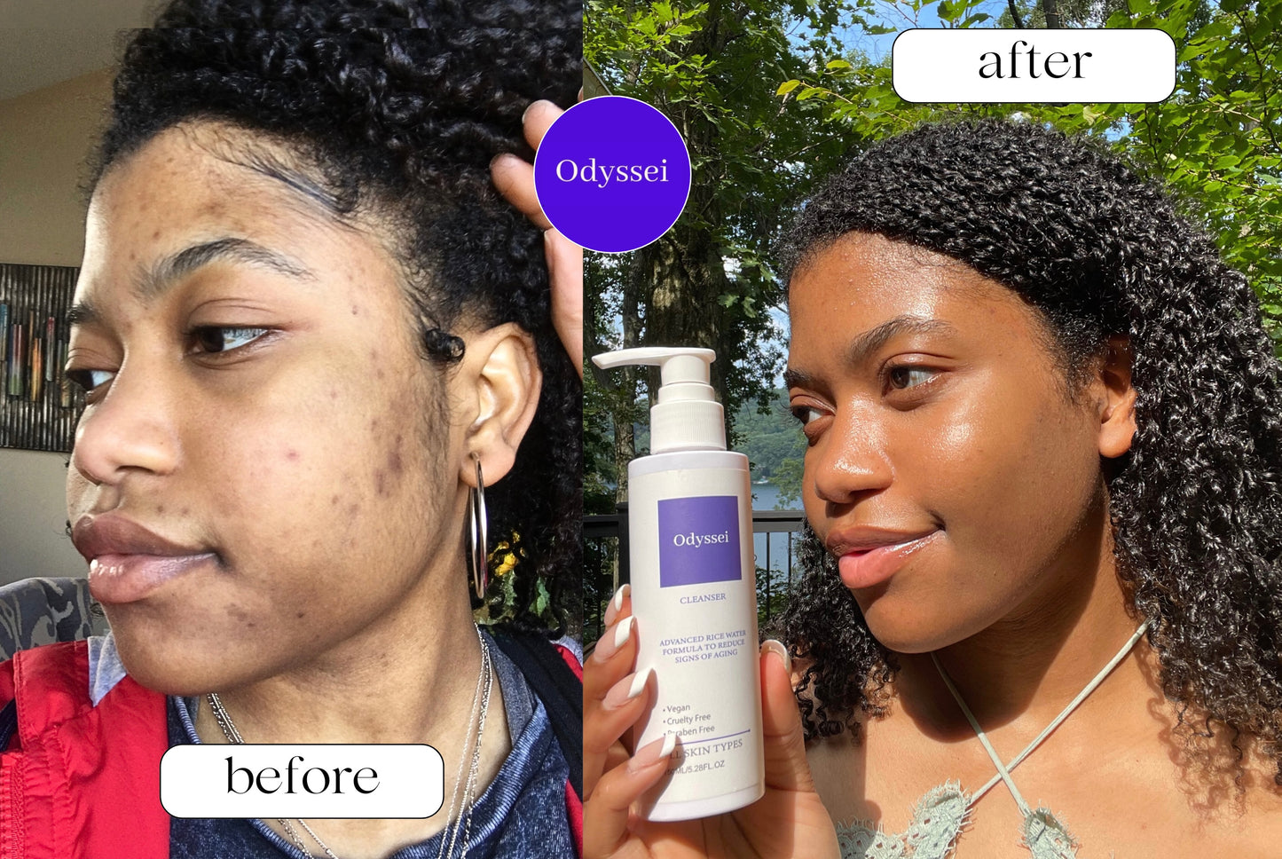 Rice Water Anti-Aging Cleanser