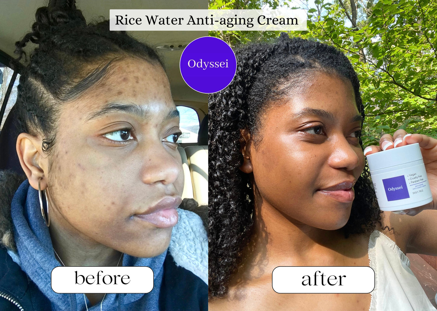 Rice Water Anti-Aging Cream