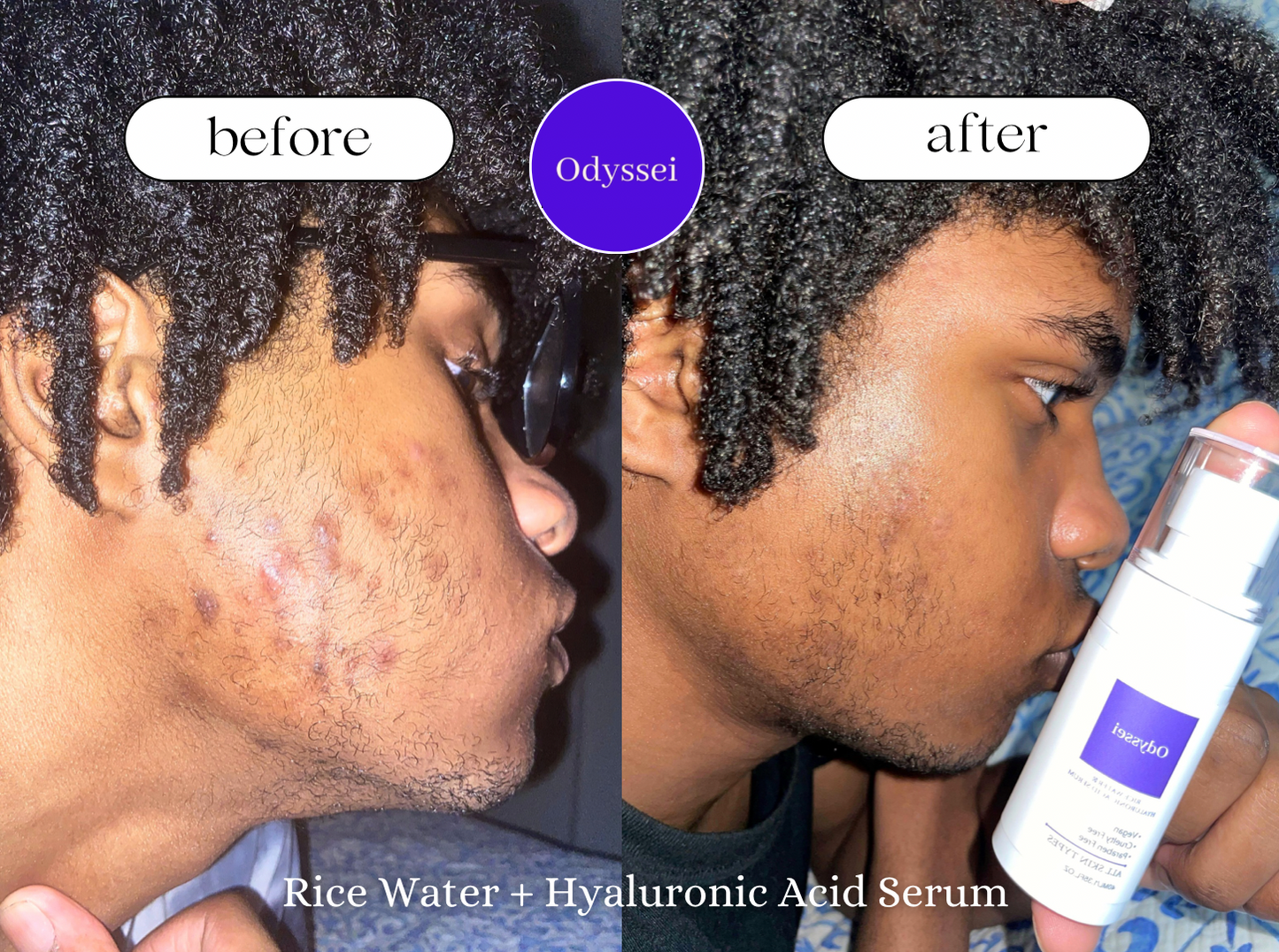 Rice Water Hyaluronic Acid Serum