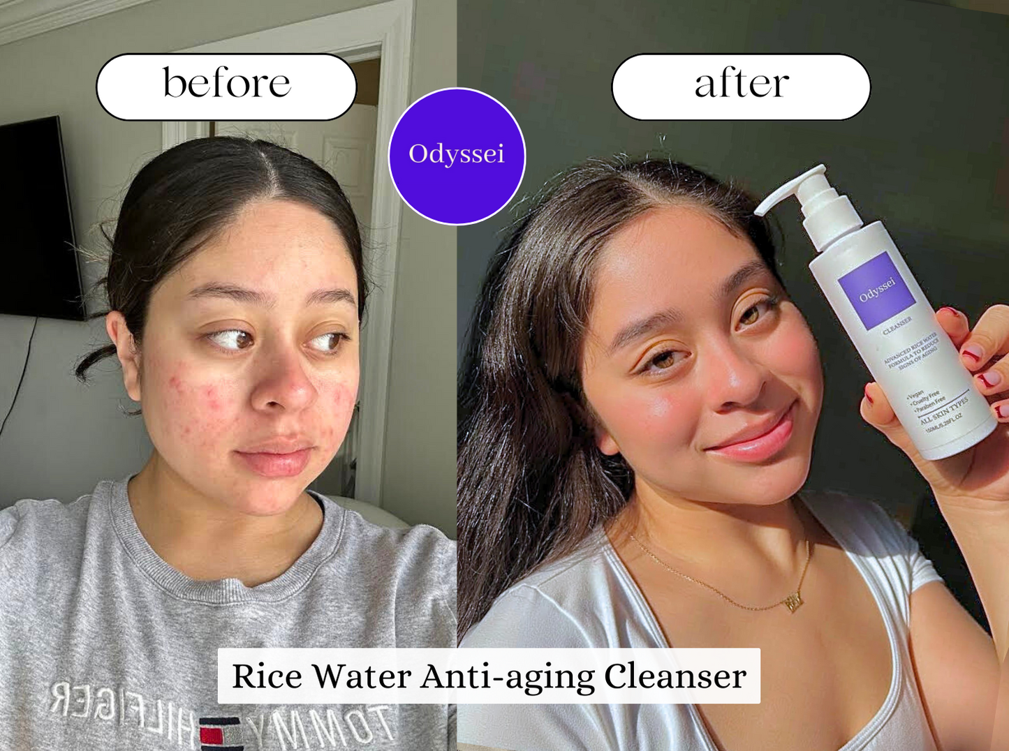 Rice Water Anti-Aging Cleanser